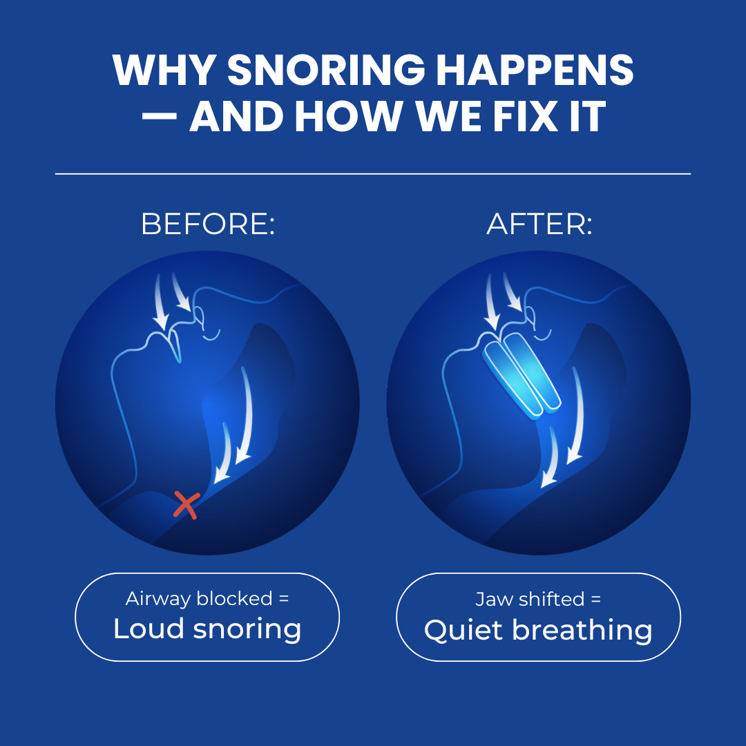 Snore Guardian